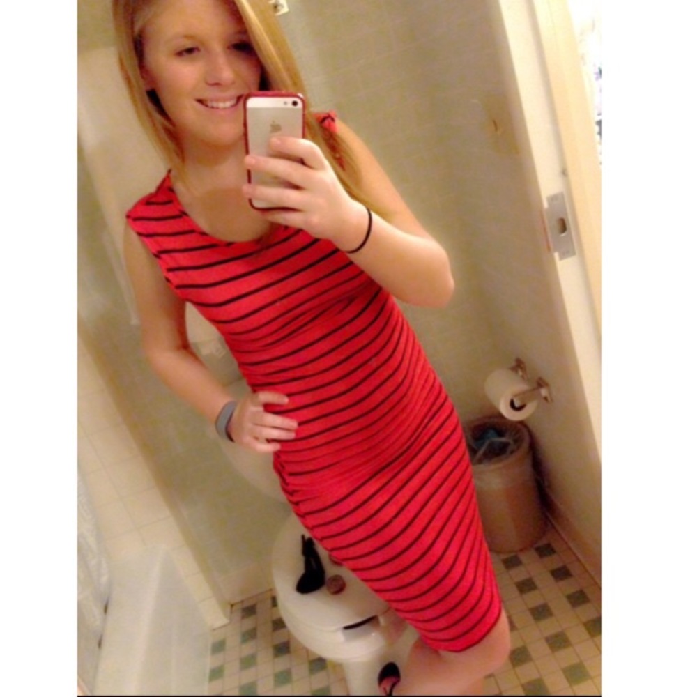 Striped form fitting dress with cut out back
